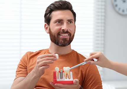 Dental Implants