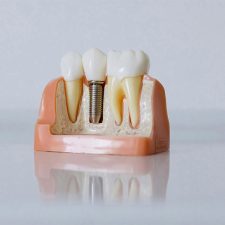 dentist near you